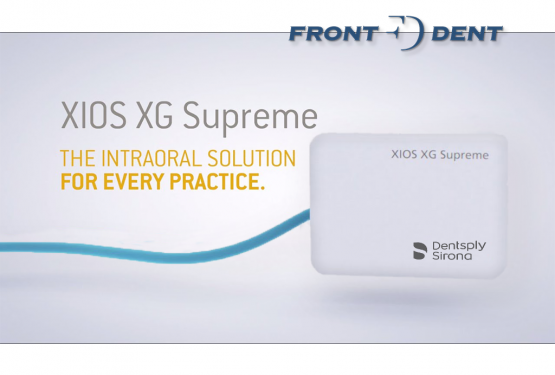 A Xios XG digitális szenzorok az iparág vezető képminőségét biztosítják
