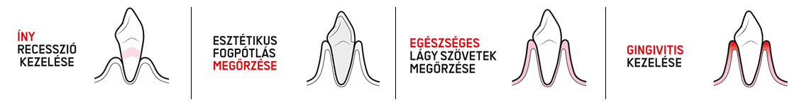 5. Ínyrecesszió kezelése 6. Esztétikus fogpótlás megőrzése 7. Egészséges lágyszövetek megőrzése 8. Gingivitis kezelése