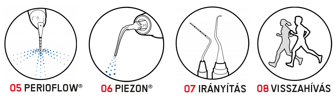 A GBT protokoll 8 lépése - Perioflow, Piezon, Irányítás, Visszahívás