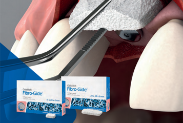 A Geistlich Fibro-Gide®