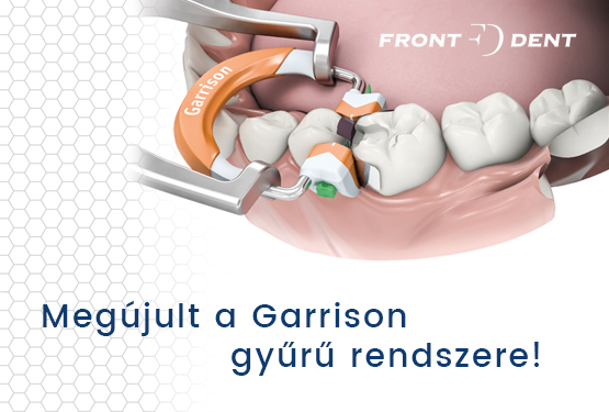 Garrison-megújult rendszerrel a kínálatunkban!