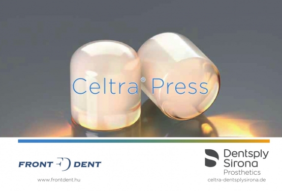 Celtra Press - Amiért más