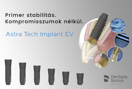 Megújult Astra Tech Implantátum rendszer