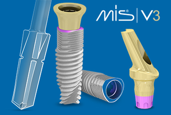 MIS V3 implantátum rendszer