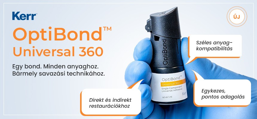 optibond