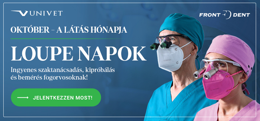 Loupe kiprobalas