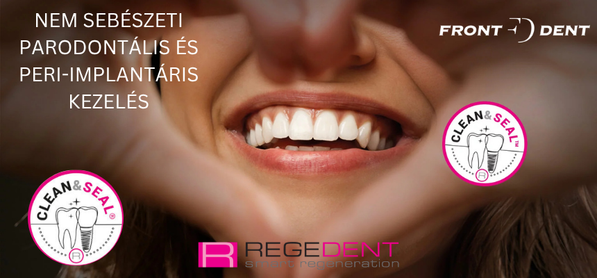 Regedent Clean and Seal 