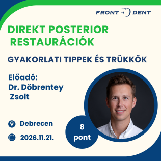 Gyakorlati tippek és trükkök a direkt posterior restaurációk világában