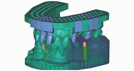 Exocad Model Creator add-on modul DentalCad, Perpetual License