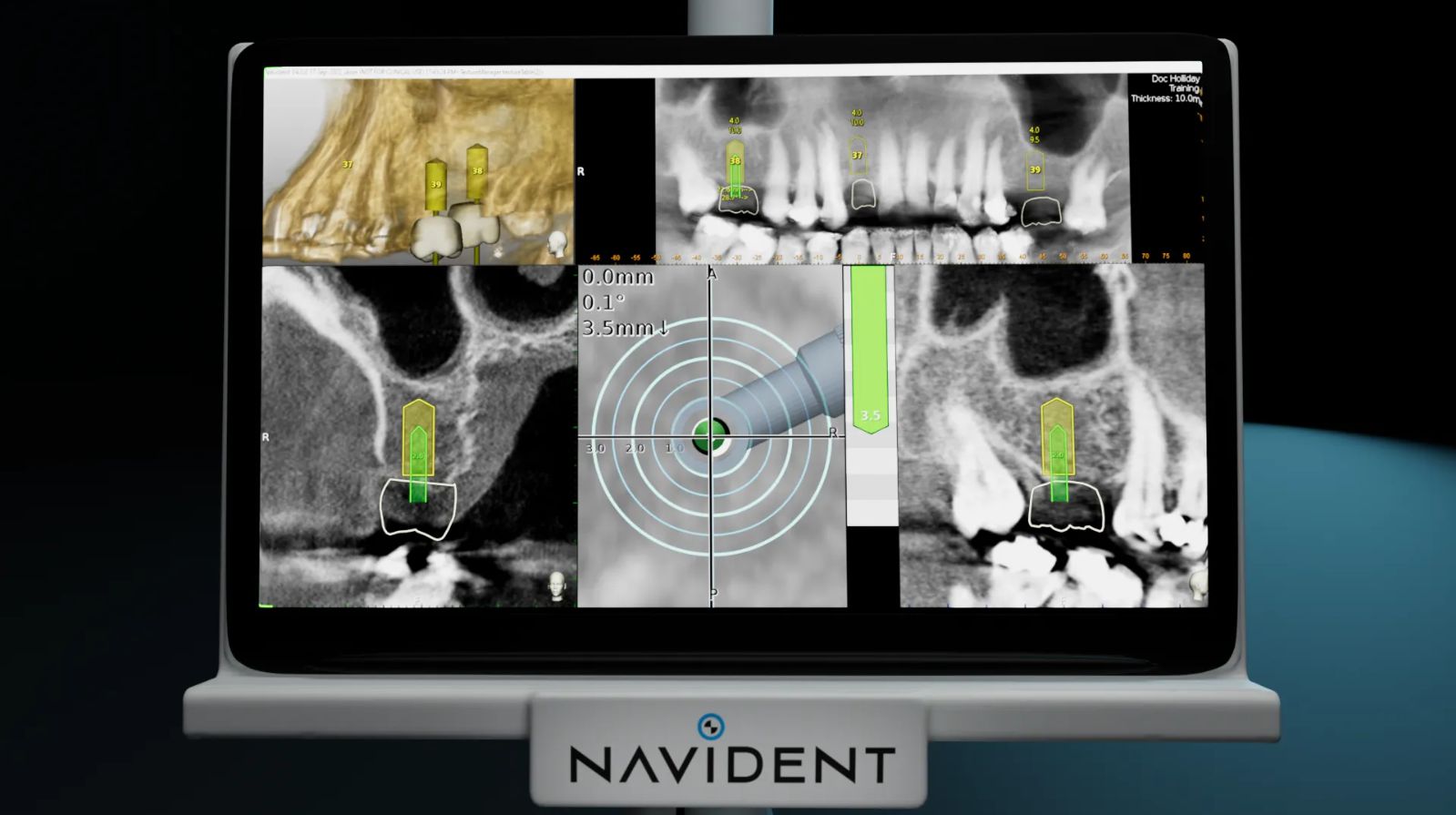 Navident 4.0 cart-based assembly