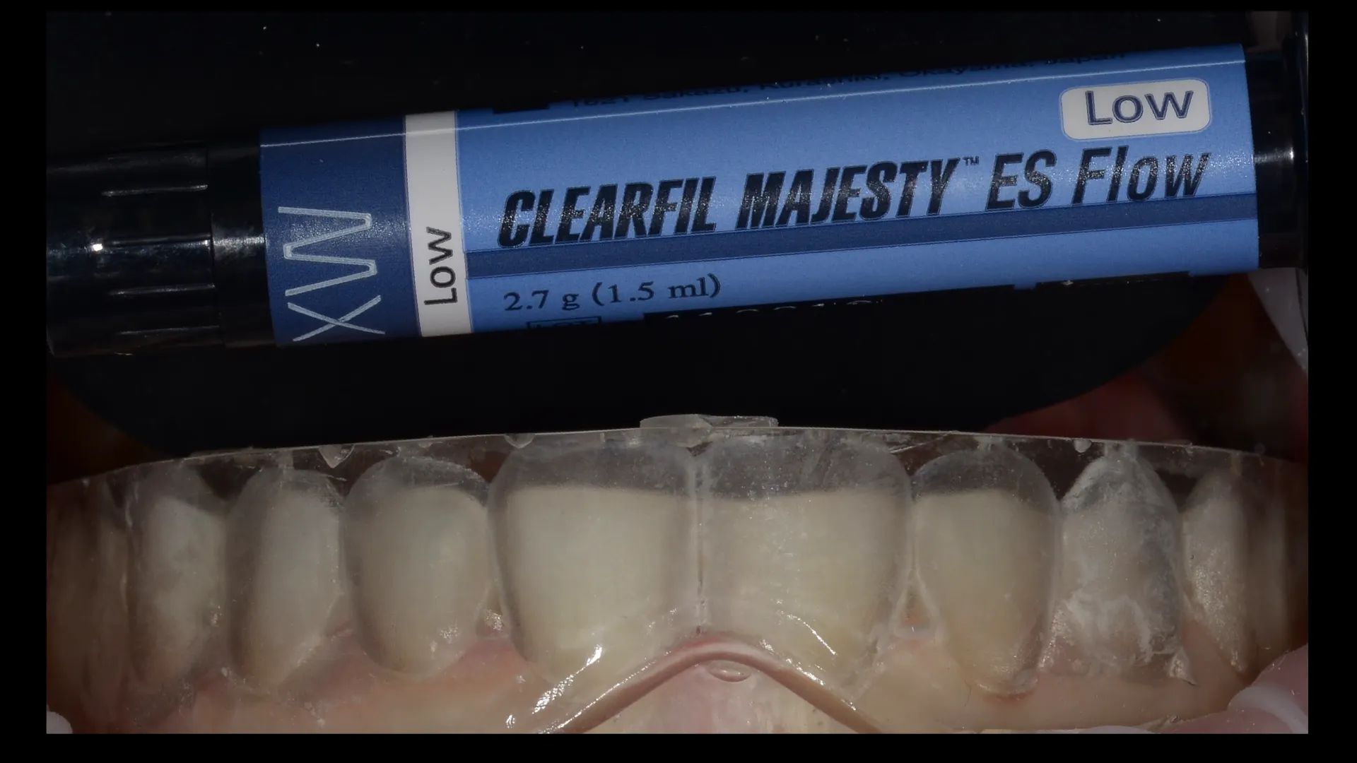 Clearfil Majesty ES Flow XW 1,5ml Spritze (Low)